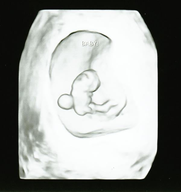 Pregnancy